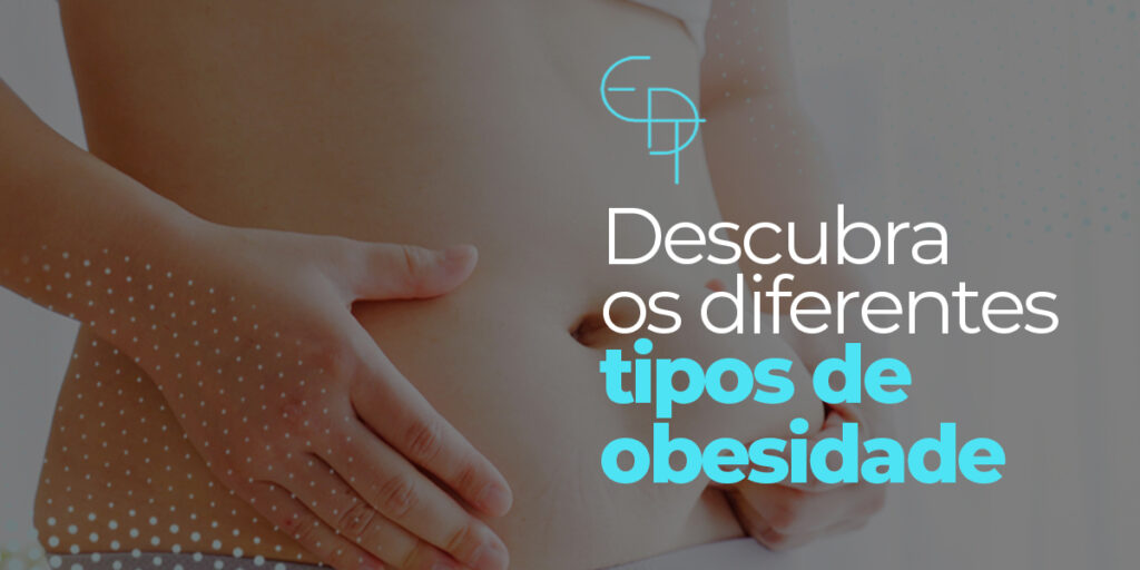 Descubra Os Diferentes Tipos De Obesidade Clínica Edt 7894