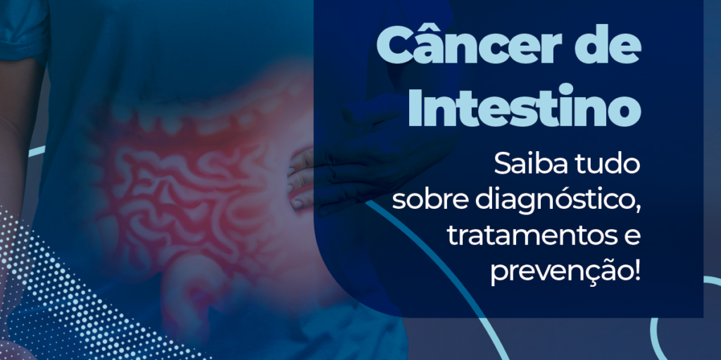 Câncer de intestino: diagnóstico, tratamentos e prevenção