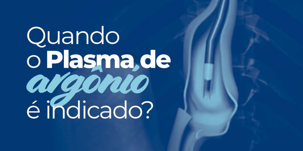 Quando o plasma de argônio é indicado?